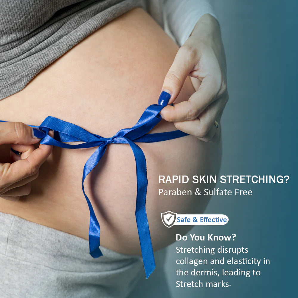 Natural Stretch Mark Cream – 100g | Gentle Care for Growing Skin image 2