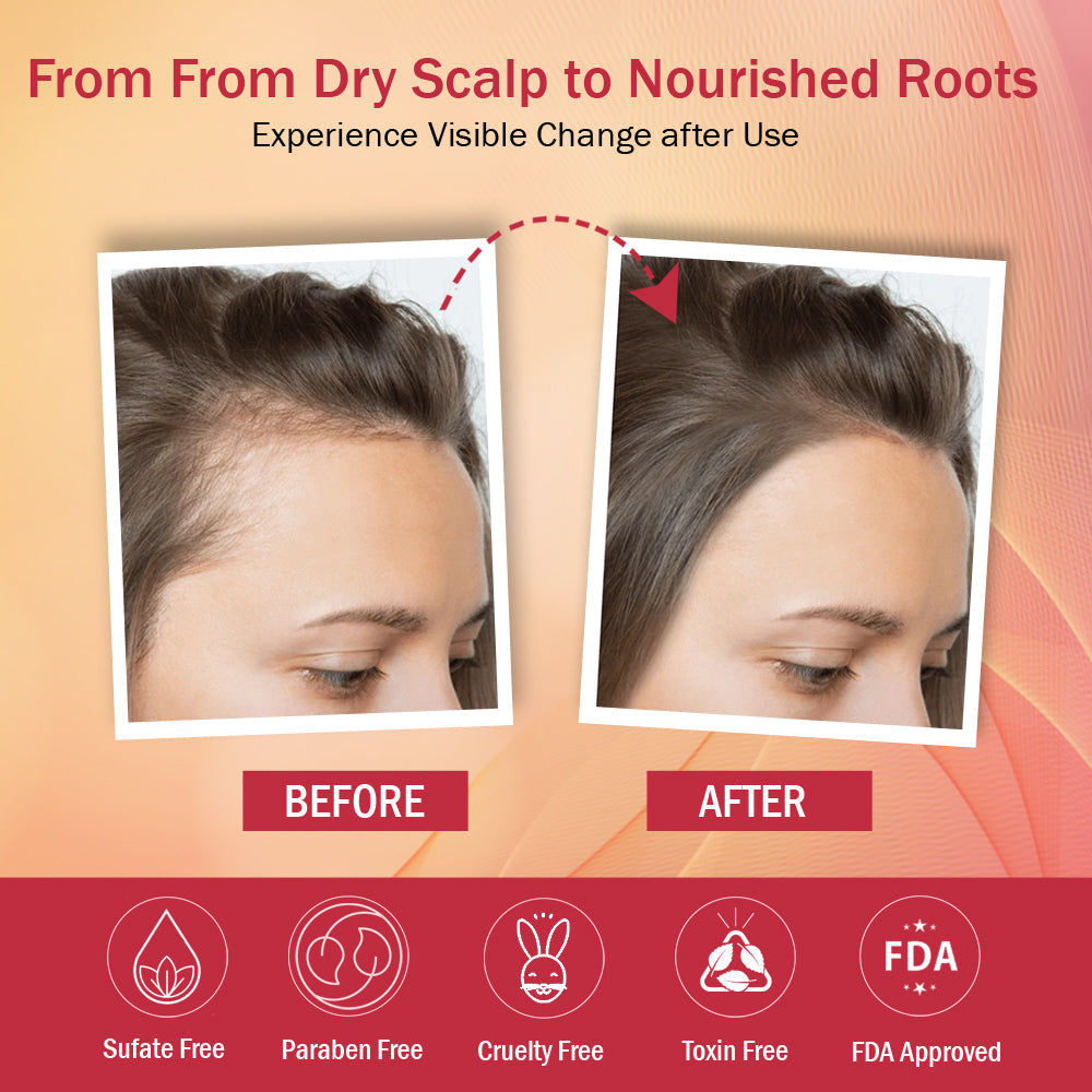 Red Onion Hair Oil Controls Hair Fall (100 ml) image 6