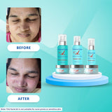 Advance Seaweed Facial Kit image 5
