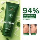 A+ Acne Face Cleanser with 0.5% Salicylic Acid – 100 gm image 4