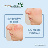 7Days Natural Acne Control Scrub With Lemon Oil & Tea Tree Oil-100 image 5