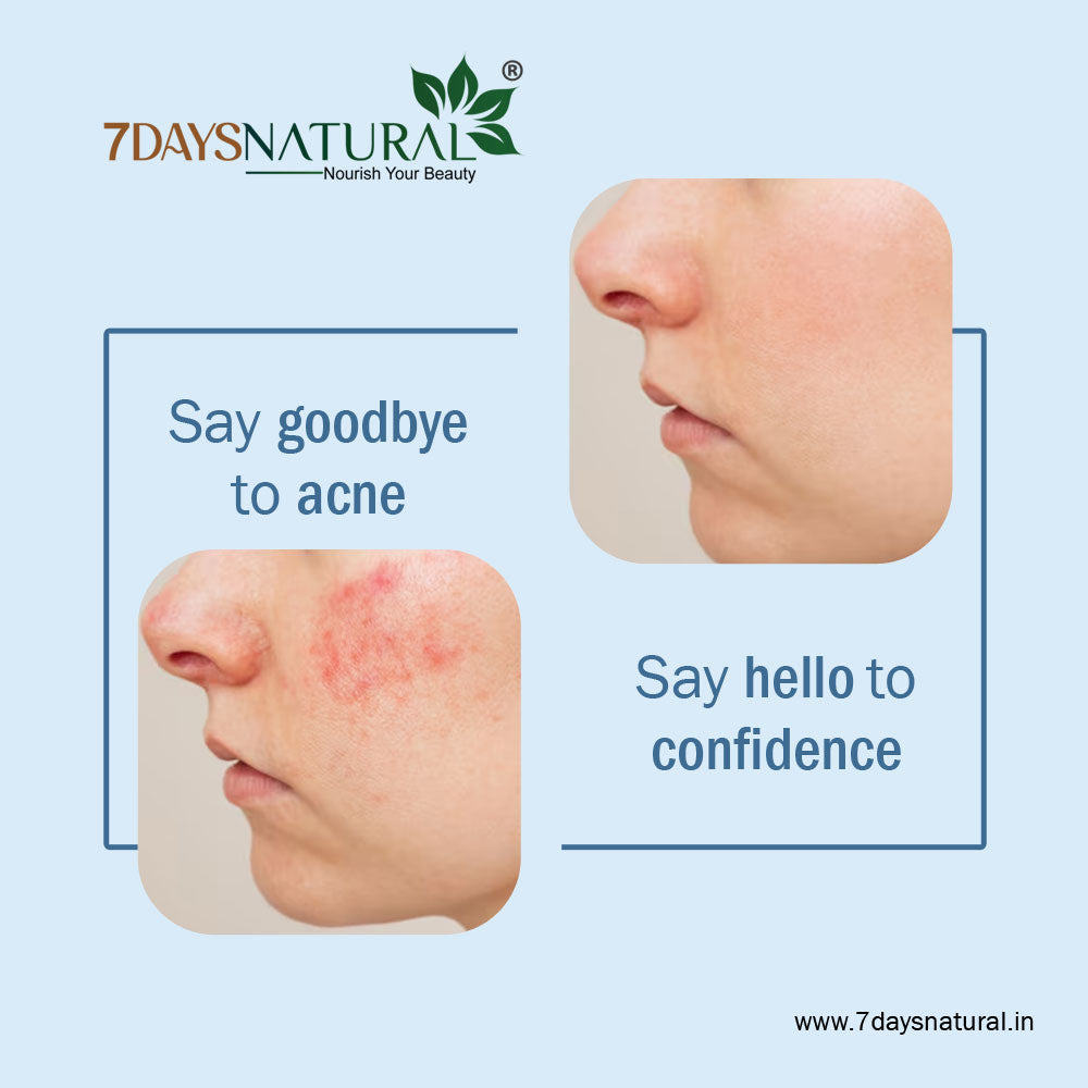 7Days Natural Acne Control Scrub With Lemon Oil & Tea Tree Oil-100 image 5