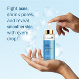 7 DAYS NATURAL Acne Face Serum For Women & Men For Acne Breakouts - 30ML image 1