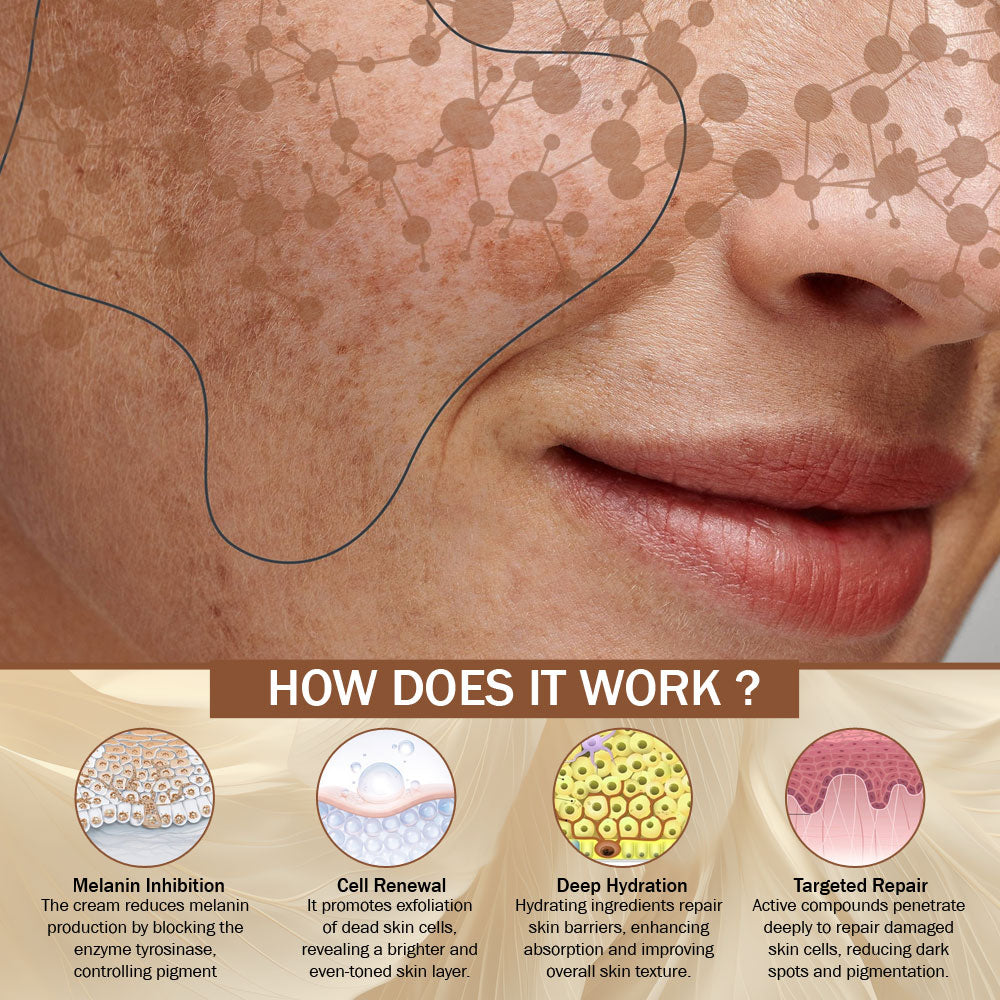 7Days Natural Pigmentation Cream for Acne Scar Removal Pigmentation, Dark Spots & face Glowing (100 g) image 2