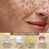 7Days Natural Pigmentation Cream for Acne Scar Removal Pigmentation, Dark Spots & face Glowing (100 g) image 2