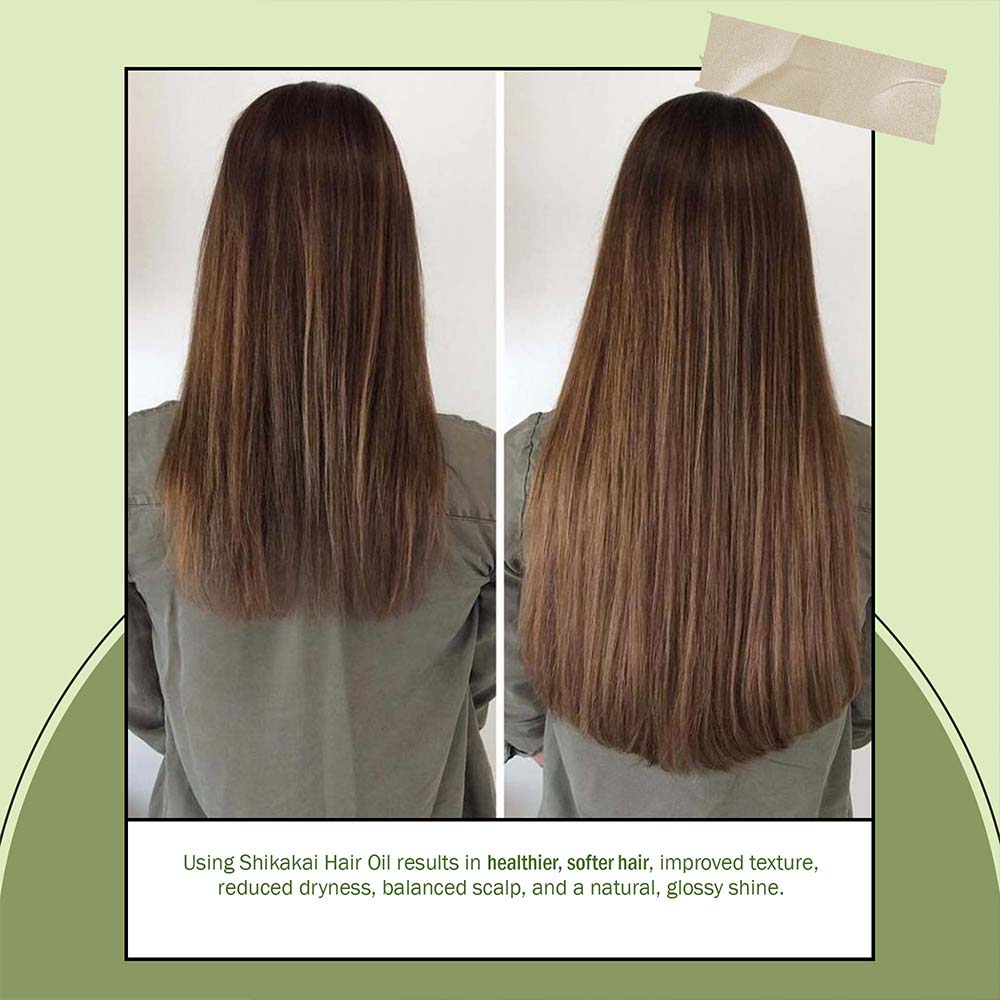7Days Natural shikakai hair fall dandruff control & new hair growth Hair Oil (100 ml) image 5