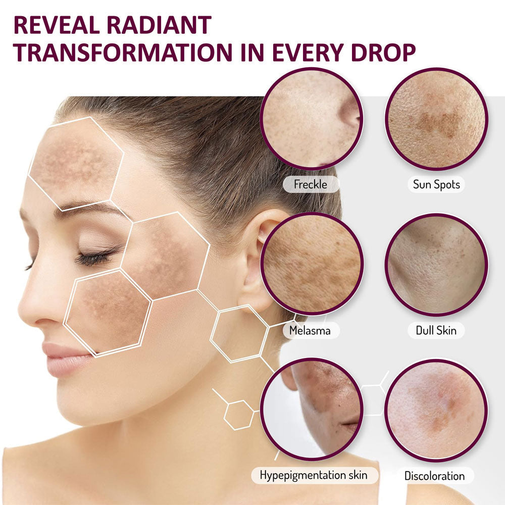 Dark Spots Removal Serum for Pigmentation & Dark Spots Removal | Anti-pigmentation Face Serum For Men & Women | 30 ml image 3