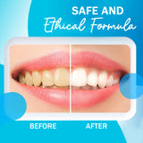 7Days Natural Activated Teeth Whitening Powder - Enamel Safe Teeth Whitener - 100g image 8
