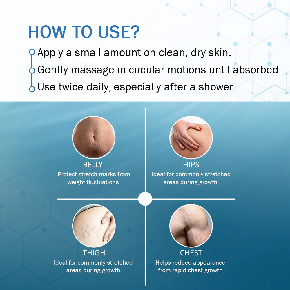 Natural Stretch Mark Cream – 100g | Gentle Care for Growing Skin image 3