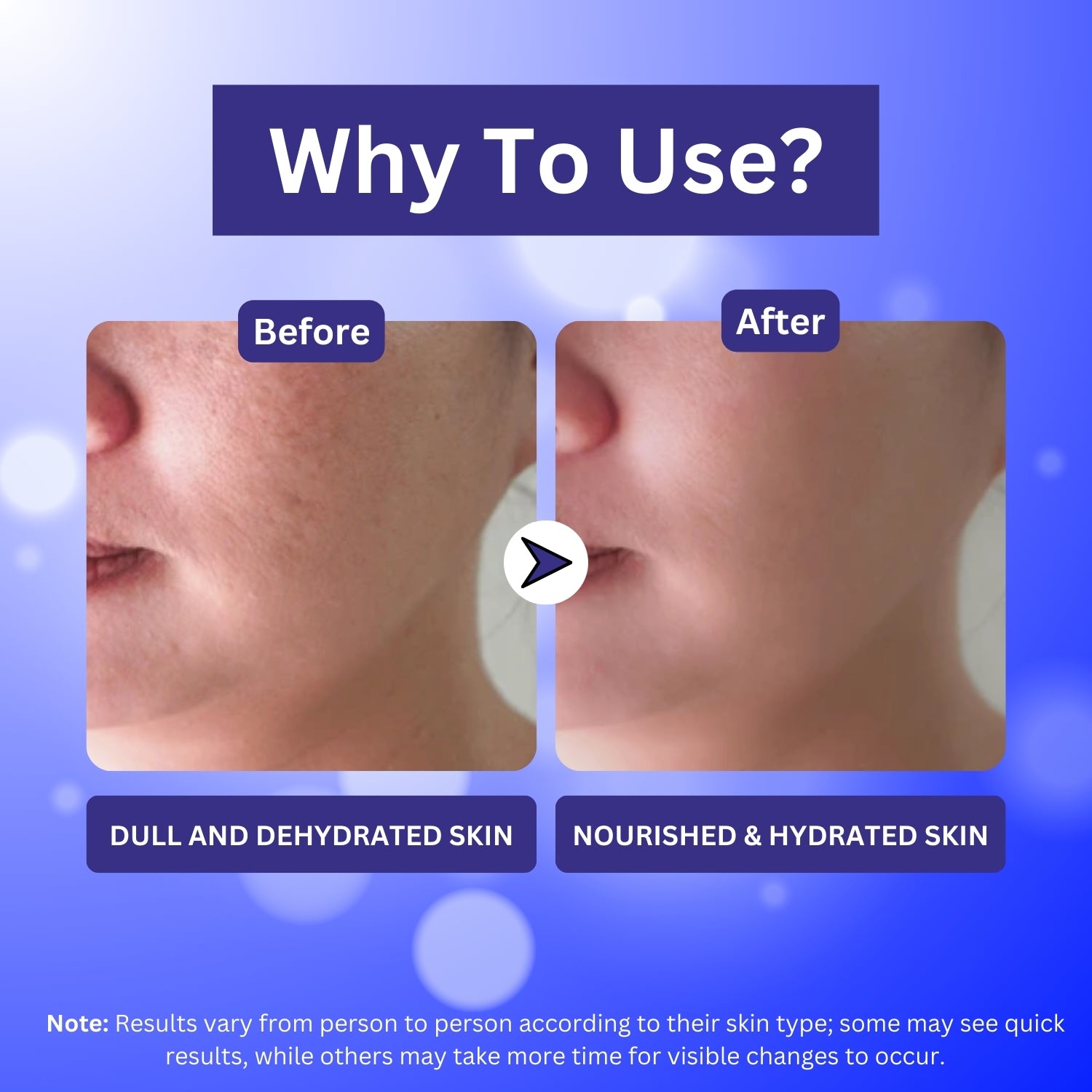 A+ Soothing Cream (50 gm) image 4