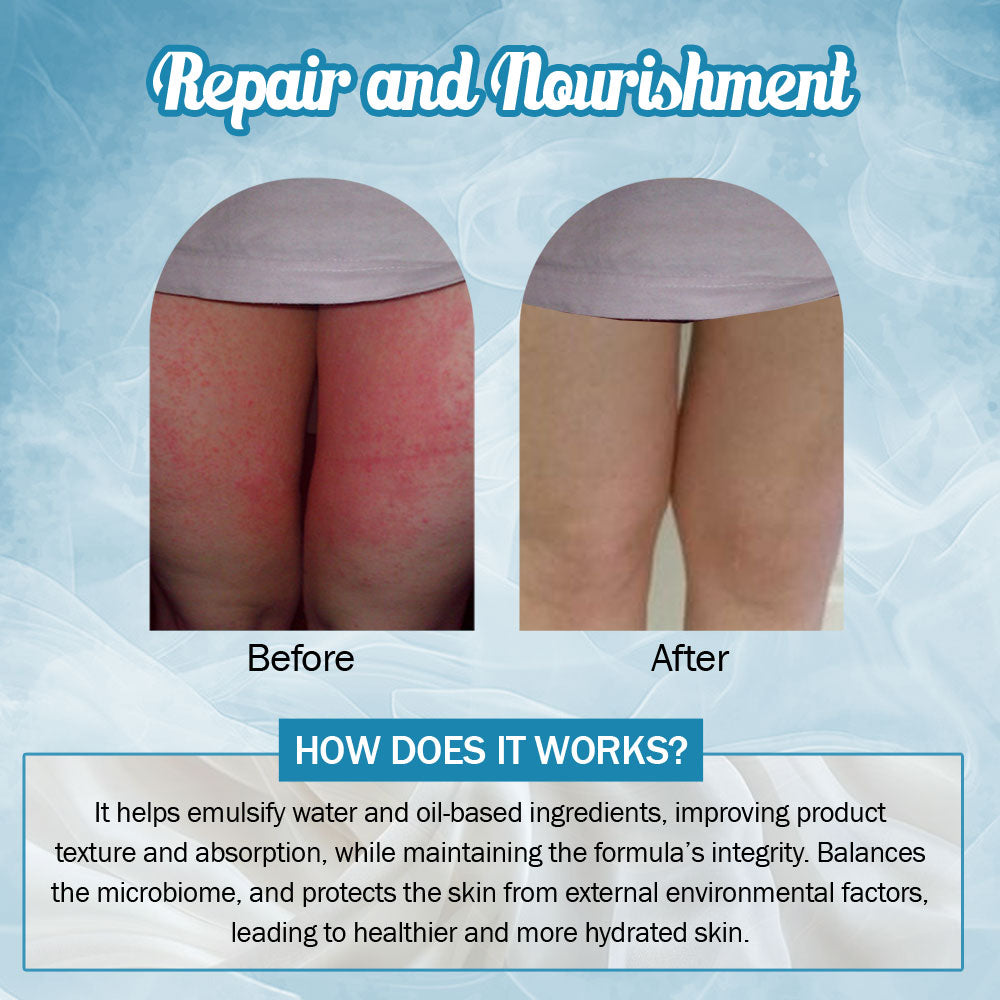 7 DAYS NATURAL Bye-Bye Chafing Cream For Skin - 50GM image 6