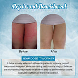 7 DAYS NATURAL Bye-Bye Chafing Cream For Skin - 50GM image 6