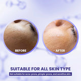 A+ Korean Glass Facial Kit, 7 Steps in 1 Kit, – 300 gm + 20 ml image 4